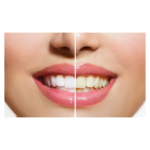 ⁦معجون أسنان مبيض بقوة إضافية من وايت قلو - 150جم⁩ - الصورة ⁦2⁩