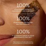 ⁦مجموعة اكني سلوشن للعناية بحب الشباب - 4 قطع⁩ - الصورة ⁦5⁩