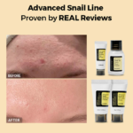 ⁦مجموعة الحلزون من كوسركس - 4 قطع⁩ - الصورة ⁦7⁩