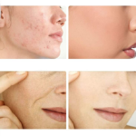 ⁦ديرما رولر 5في1 للعناية بالبشرة⁩ - الصورة ⁦4⁩