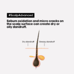 ⁦شامبو سكالب أدفانسد المنقّي لفروة الرأس ضدّ الدهون من لوريال بروفيشنال - 300مل⁩ - الصورة ⁦2⁩