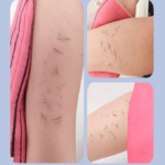 ⁦الليفة الكورية لتقشير الجسم من سيفيزا - وردي⁩ - الصورة ⁦4⁩