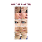 ⁦كي سيكرت لصقات جل للعين ادفانسد ريجينيريتينغ بالريتينول - 60 قطعة⁩ - الصورة ⁦5⁩