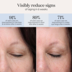 ⁦سموذ سكين لصقات العين دو لوكس ميني للعلاج بالضوء⁩ - الصورة ⁦4⁩