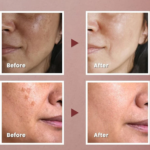 ⁦كي سيكرت مرطب كولاجين فيتا - 11ج⁩ - الصورة ⁦2⁩