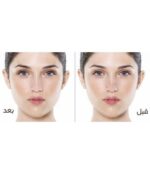 ⁦لصقات الانف من كيلان⁩ - الصورة ⁦3⁩