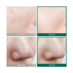 ⁦تونر العناية AHA BHA PHA من سوم باي مي - 150مل⁩ - الصورة ⁦2⁩