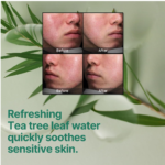 ⁦مجموعة العناية بالبشرة الدهنية - 5 قطع⁩ - الصورة ⁦3⁩