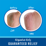 ⁦اوكيفز كريم القدمين الصحية هيلثي فيت للترطيب - 181جم⁩ - الصورة ⁦4⁩