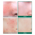 ⁦سيروم العناية AHA BHA PHA من سوم باي مي - 50مل⁩ - الصورة ⁦2⁩