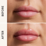 ⁦غوش قلوس ملمع شفاه ليب فيلر⁩ - الصورة ⁦3⁩