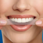 ⁦لصقات بروفيشنال وايت مع ليد لايت لتبييض الأسنان من كرست ثري دي - 38 شريحة⁩ - الصورة ⁦3⁩