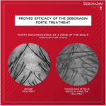 ⁦سيبورادين فورت ماسك مكثف لتقوية الشعر - 150 مل⁩ - الصورة ⁦4⁩