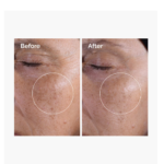 ⁦مجموعة العناية المتقدمة لتوحيد لون البشرة - 4 قطع⁩ - الصورة ⁦7⁩