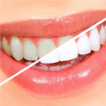 ⁦معجون أسنان ومبيض من لاكالوت - 75مل⁩ - الصورة ⁦3⁩