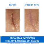 ⁦يورياج باريديرم سيكا كريم لعلاج الحروق و الجروح - 40مل⁩ - الصورة ⁦3⁩