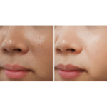 ⁦مجموعة العناية المتقدمة لتوحيد لون البشرة - 4 قطع⁩ - الصورة ⁦5⁩