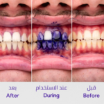 ⁦سيروم مصحح لون الأسنان v34 من هاي سمايل - 30مل⁩ - الصورة ⁦3⁩