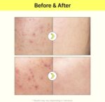 ⁦تيام سيروم فيتامين بي 3 للبشرة - 40 مل⁩ - الصورة ⁦3⁩