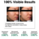 ⁦مجموعة العناية بالبشرة الدهنية - 5 قطع⁩ - الصورة ⁦5⁩