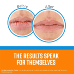 ⁦مرطب الشفاه لإصلاح الشفاه من اوكيفس - 4.2 غ⁩ - الصورة ⁦4⁩