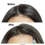 ⁦لوريال بروفيشنال سيروم شعر سكالب أدفانسد انتي-اويلينيس 5 في 1 - 90 مل⁩ - الصورة ⁦3⁩