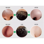 ⁦ماسك لإزالة الرؤوس السوداء بالفحم من ليزر وايت - 50مل⁩ - الصورة ⁦2⁩