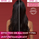 ⁦سيروم أمينيكسيل مقاوم لتساقط الشعر إلفيف من لوريال باريس - 102مل⁩ - الصورة ⁦5⁩